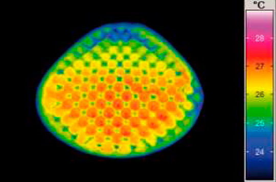 Imagen térmica de la investigación para prótesis de mama